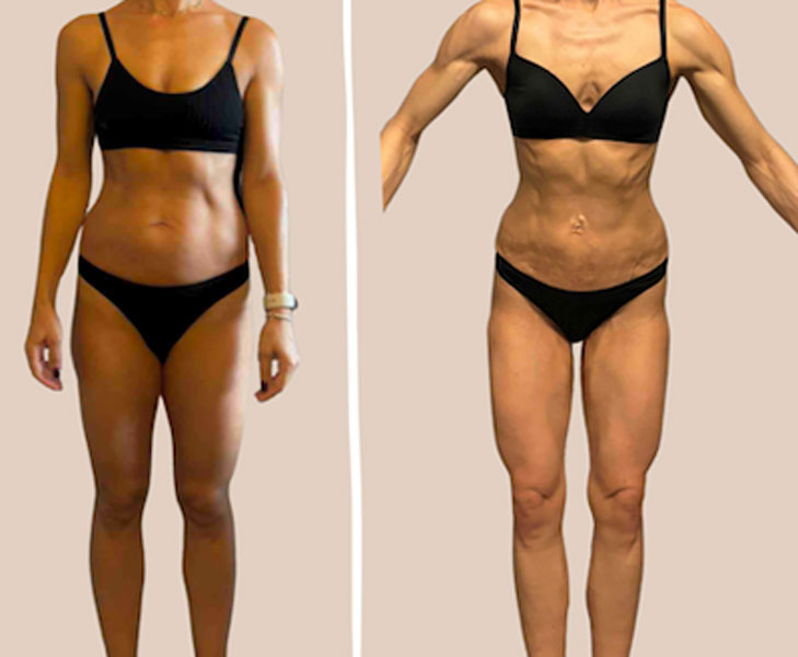 Transformation 3